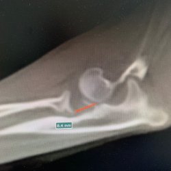 RTG snímek končetina Rozárka